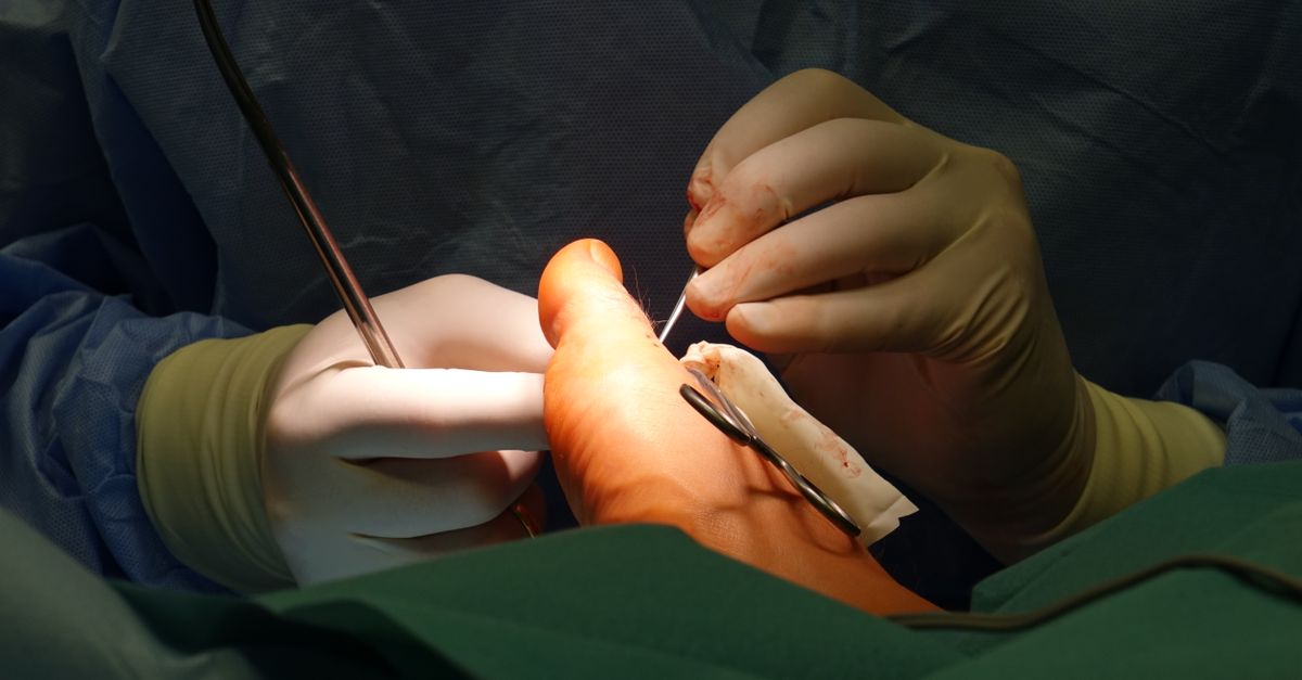 Extensor Tendonitis Top of Foot: Causes, Care & Recovery