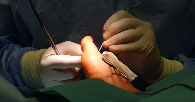 Extensor Tendonitis Top of Foot: Causes, Care & Recovery